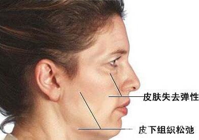 電波拉皮*果嗎？