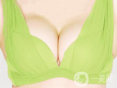 假體豐胸手術(shù)大概多少錢