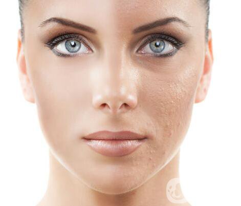 熱瑪吉,熱瑪吉*果