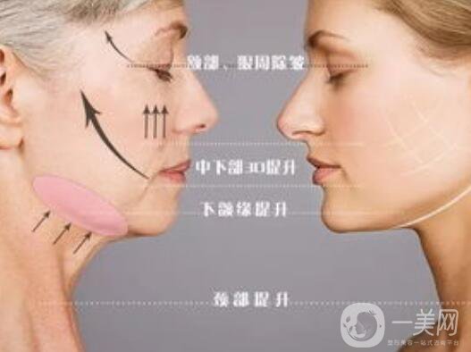 熱瑪吉,熱瑪吉*果