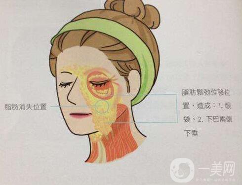 電波拉皮手,電波拉皮手術(shù)多少錢(qián),成都電波拉皮手術(shù)多少錢(qián)