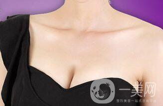 國產隆胸假體,國產隆胸假體的價格