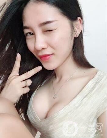 娜高220假體豐胸有多大 娜高豐胸有哪些優(yōu)勢