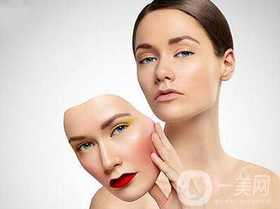 顴骨內推手術*嗎？