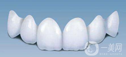 金鈀合金烤瓷牙,金鈀合金烤瓷牙危害