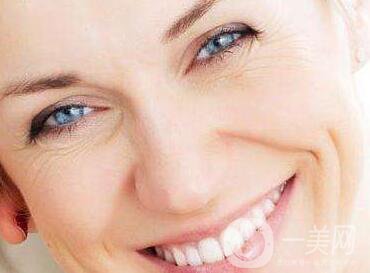 自體脂肪去法令紋怎么樣？