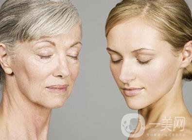 成都電波拉皮一次多少錢