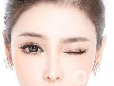 昆明割雙眼皮多少錢