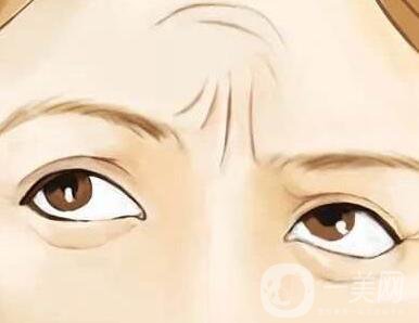 *去抬頭紋*果,*去抬頭紋*果維持多久