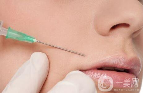 玻尿酸去法令紋,深圳玻尿酸去法令紋價格