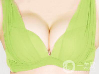 假體隆胸手術*嗎