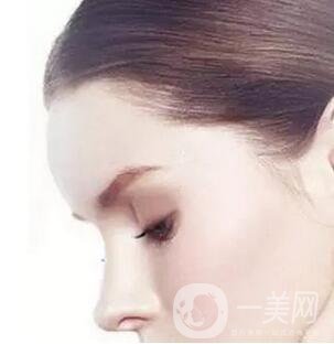 玻尿酸豐額頭維持多久？