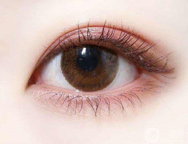 割雙眼皮,割雙眼皮維持多久,割雙眼皮多久恢復(fù)