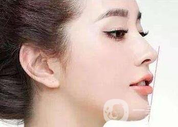 做完*注意事項(xiàng)有哪些？