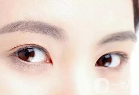 玻尿酸豐眉弓*嗎？