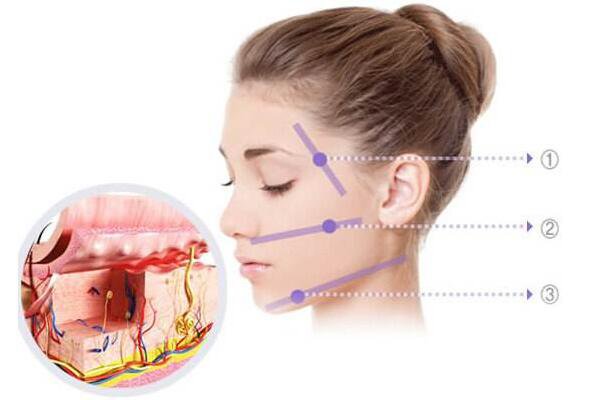 深藍(lán)射頻,熱瑪吉,深藍(lán)射頻和熱瑪吉區(qū)別