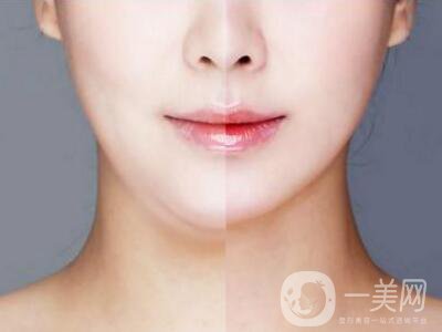 光纖溶脂減肥的危害主要有哪些？