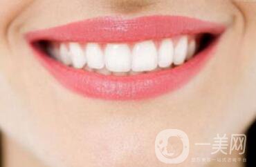 上海天包地牙齒矯正費(fèi)用是多少