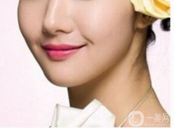 北京膨體墊下巴多少錢,膨體墊下巴注意事項