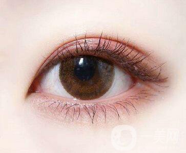 雙眼皮拆線后熱敷好嗎？