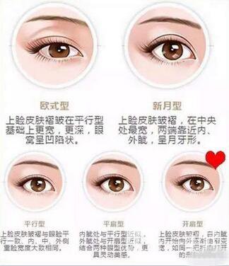 雙眼皮拆線后熱敷好嗎？