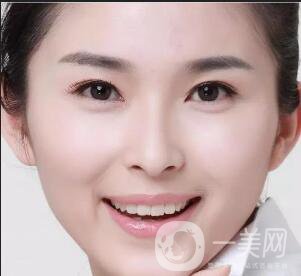 玻尿酸豐蘋(píng)果肌術(shù)后多久*果自然