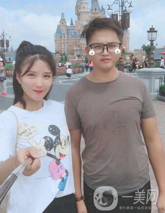 全開雙眼皮和開眼角