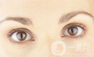 雙眼皮失敗修復,雙眼皮失敗修復多少錢