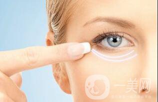 自體脂肪填充淚溝維持時間,自體脂肪填充淚溝價格