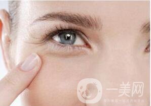 北京去魚尾紋多少錢,去魚尾紋多少錢,去魚尾紋