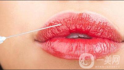 玻尿酸豐唇術后護理要注意什么