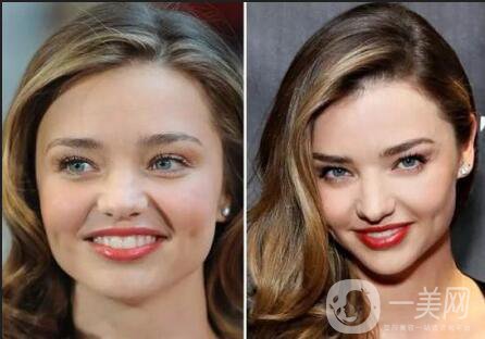 深圳去眼袋填淚溝手術(shù)一共需要多少錢