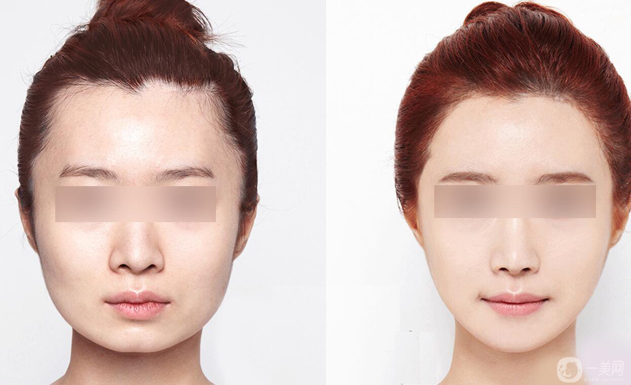 北京*價(jià)格,*價(jià)格,*