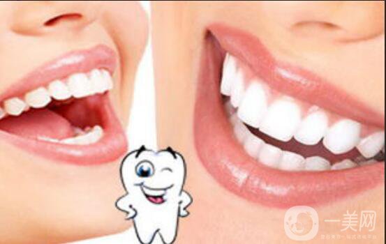 洗牙,洗牙的利與弊