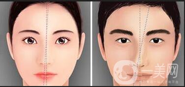 北京歪鼻矯正,北京歪鼻矯正費用