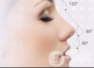 廣東駝峰鼻矯正費用,駝峰鼻矯正費用