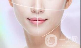 北京光纖溶脂去雙下巴多少錢,光纖溶脂去雙下巴多少錢