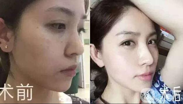 *術(shù)后護(hù)理