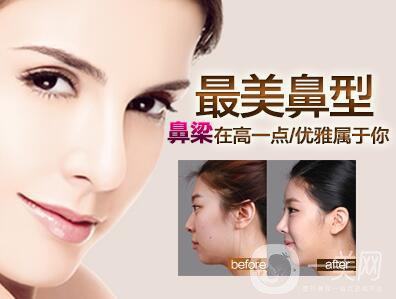 上海肋軟骨隆鼻多少錢,肋軟骨隆鼻多少錢,肋軟骨隆鼻