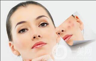 手術(shù)祛疤術(shù)后護理