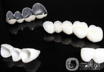 全瓷牙和烤瓷牙的區(qū)別