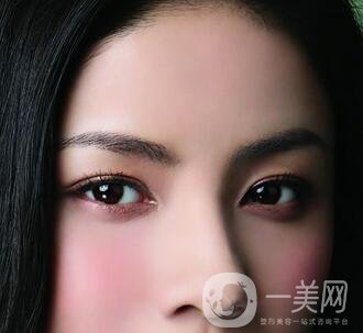 還在離不開雙眼皮貼嗎？雙眼皮手術(shù)助你雙眸