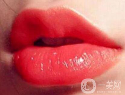 玻尿酸豐唇珠*果