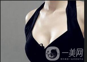 成都假體隆胸手術(shù)費用