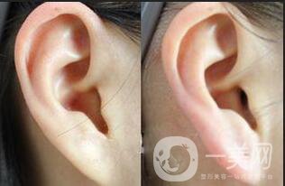 廣東豐耳垂多少錢