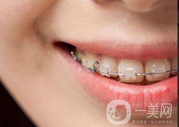 種植牙過(guò)程