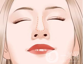 墊鼻尖用什么材料*好