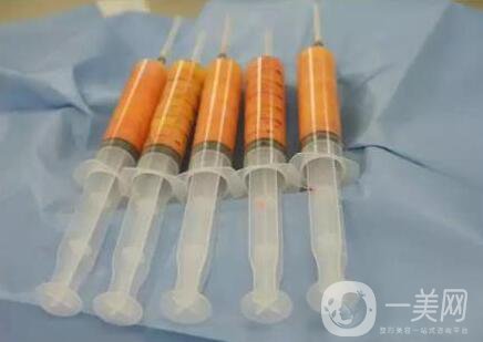 廣東做自體脂肪去法令紋的價格大概多少錢