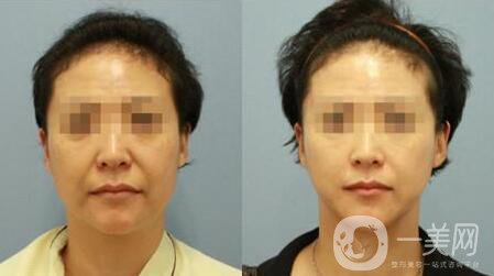 *注意事項(xiàng)及術(shù)后護(hù)理工作介紹