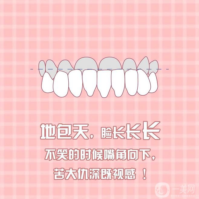 地包天矯正報價